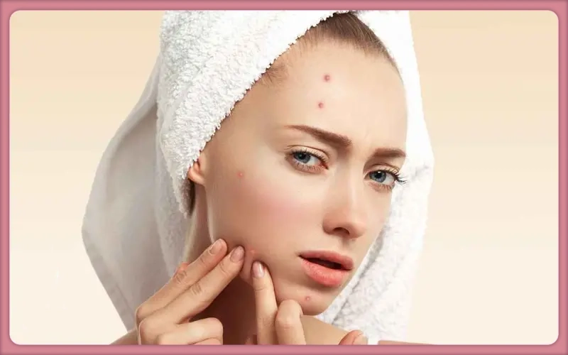 چرا بعد از وکس صورت جوش و دانه های قرمز ایجاد می شود؟