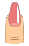 ناخن تابوتی