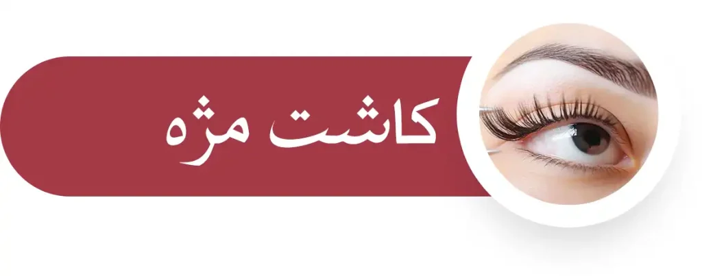 کاشت مژه
