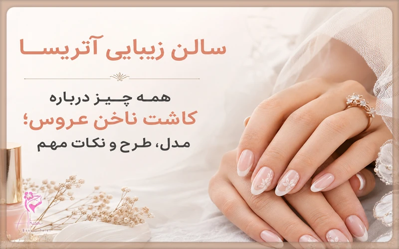 همه چیز درباره کاشت ناخن عروس